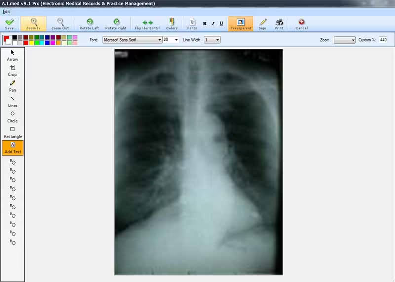 Snapshot 2