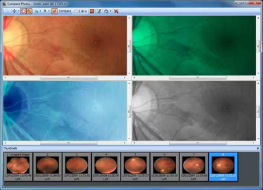 Snapshot 1