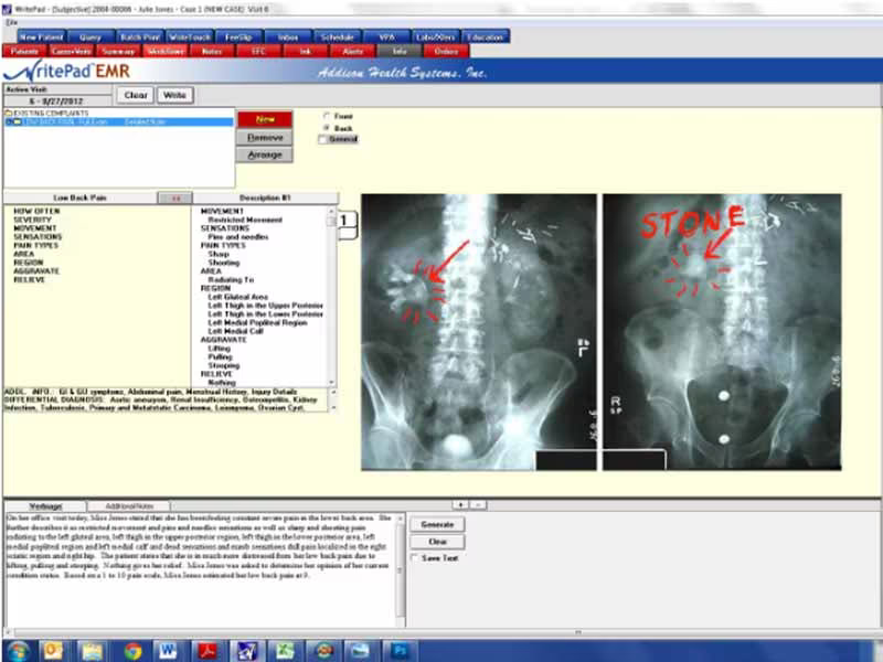 Snapshot 3